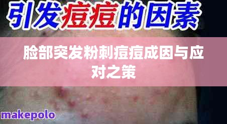 脸部突发粉刺痘痘成因与应对之策