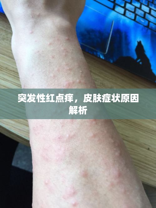 突发性红点痒，皮肤症状原因解析