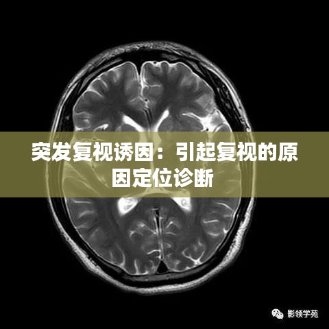 突发复视诱因：引起复视的原因定位诊断 