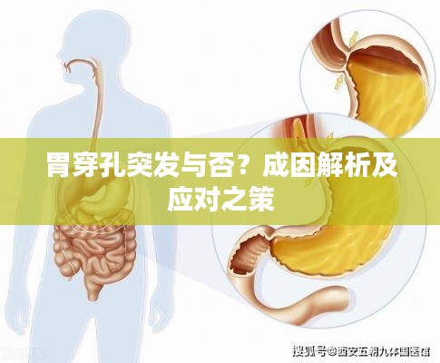 胃穿孔突发与否？成因解析及应对之策