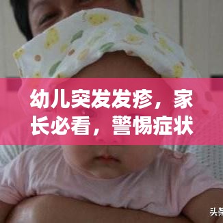 幼儿突发发疹，家长必看，警惕症状，守护宝贝健康