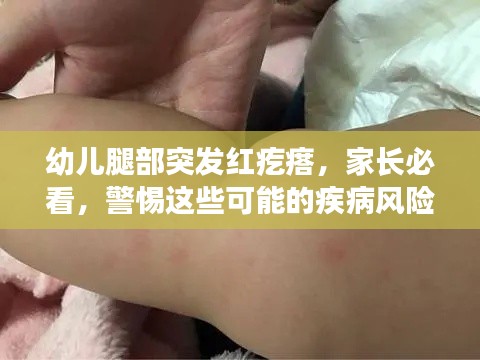 幼儿腿部突发红疙瘩，家长必看，警惕这些可能的疾病风险！